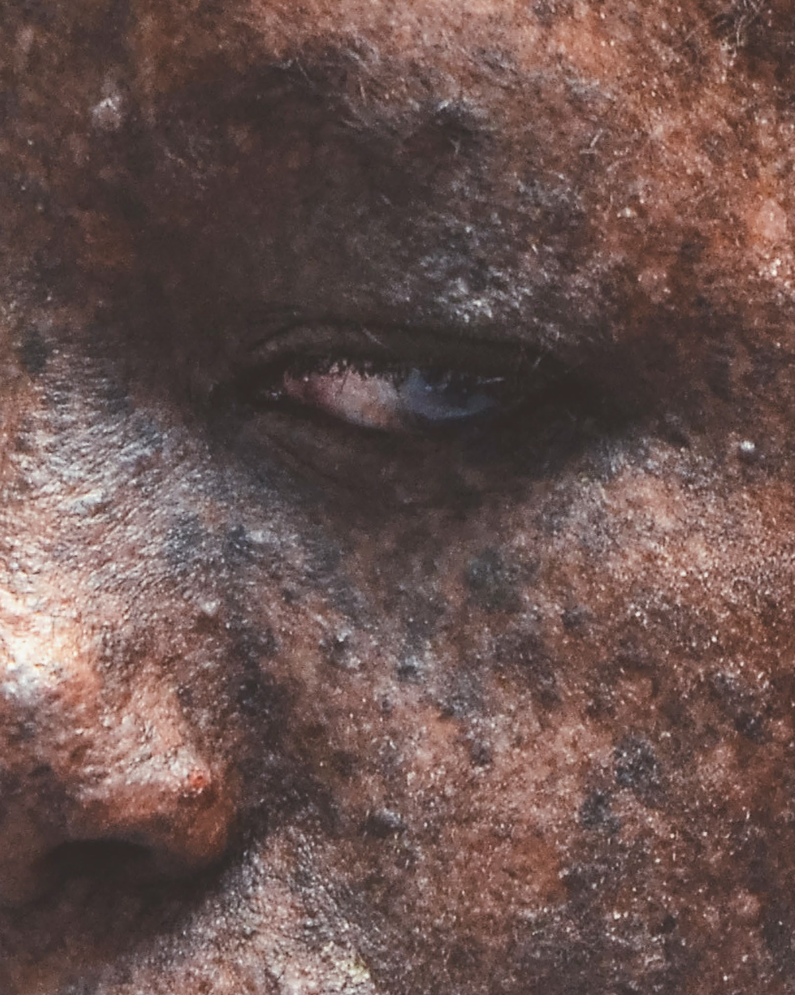 Détail rapproché d’un œil et de la peau